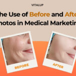 Before and after treatment photo in cosmetic clinic