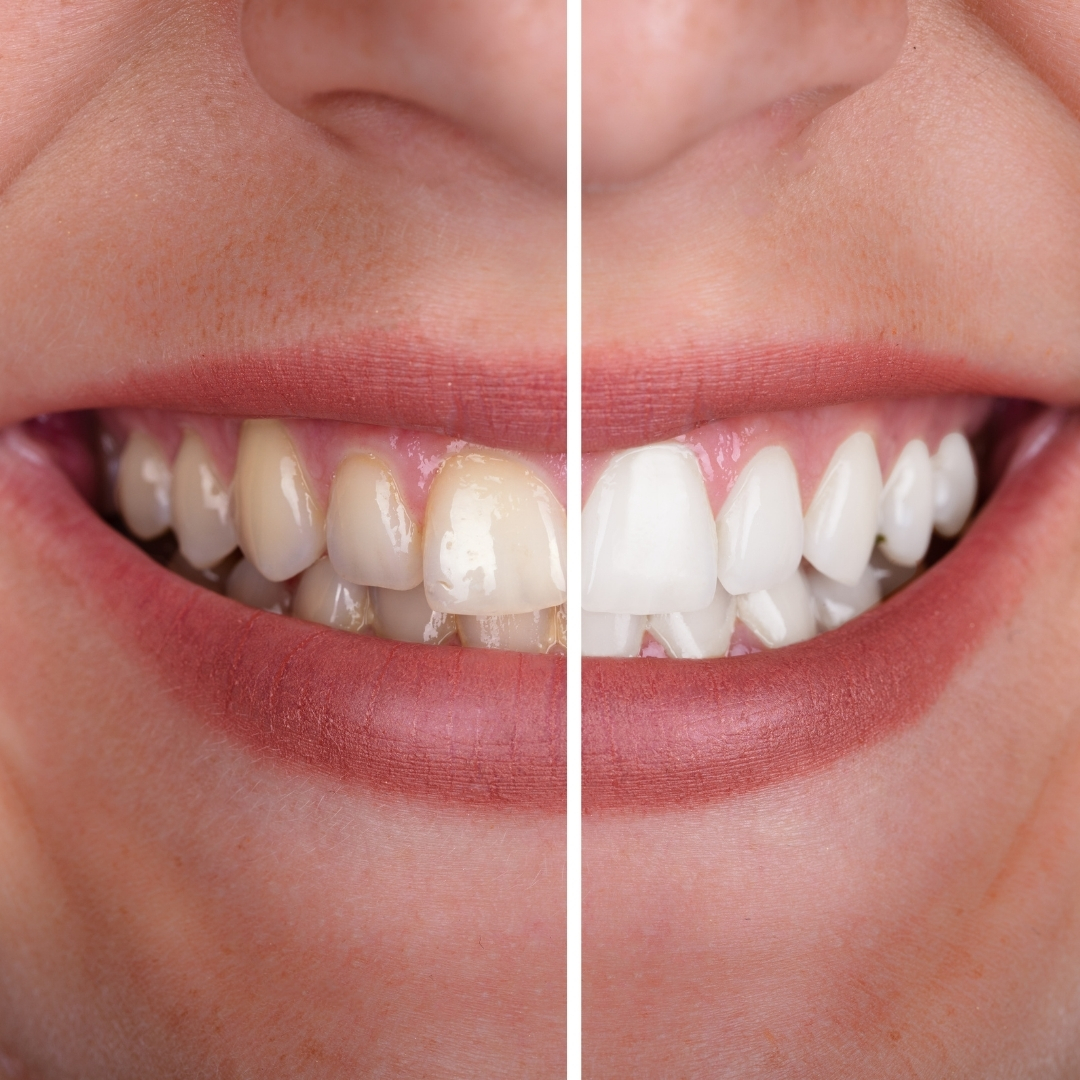 Effective dental website features for patient engagement